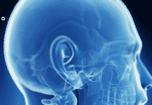 Genomic Test Helps Identify Thyroid Nodules That Don’t Require Surgery