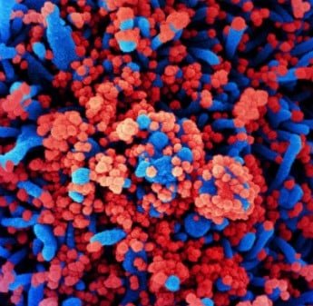 electron micrograph