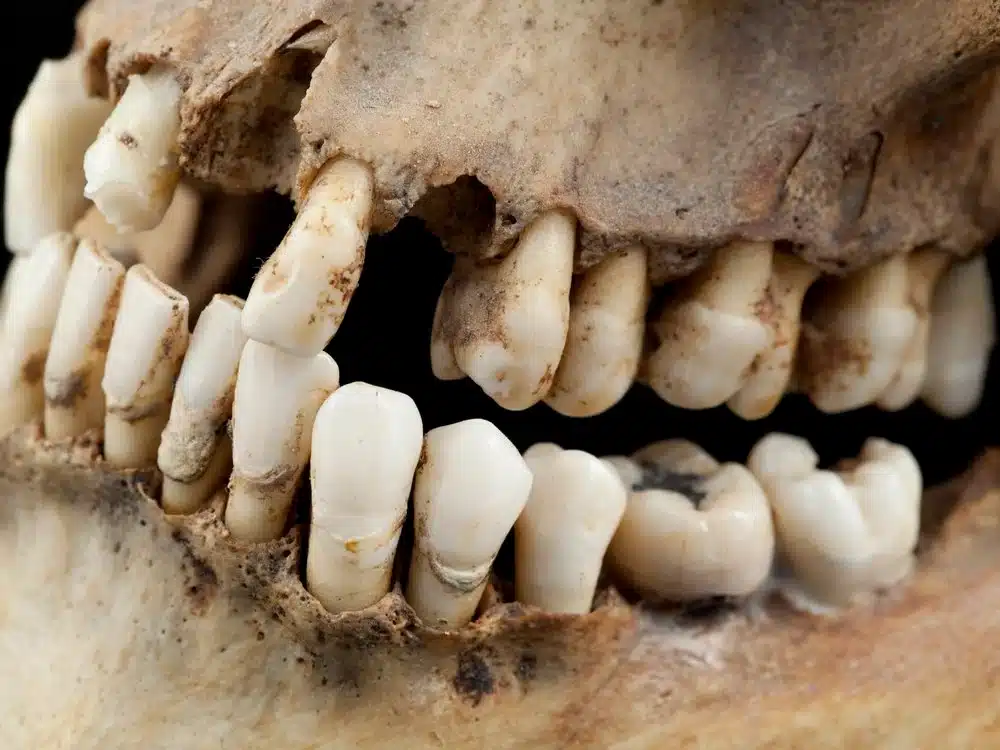 ancient-teeth