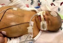 US Mother’s Tragedy: “So My Newborn Alex Died days after Receiving Unauthorized Vaxxed Blood in a Transfusion”